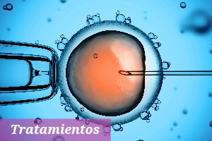 la mejor Inseminacion artificial asistida españa